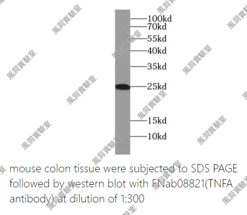 FineTest未标记一抗 TNF alpha antibody,TNF-a,适用ELISA,IHC,WB