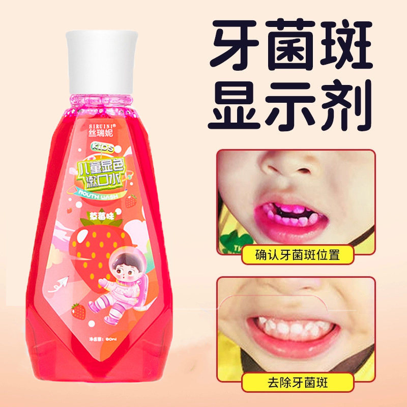 菌斑显示剂儿童祛去牙渍牙垢黄牙速效变色漱口水检测仪染色剂液体