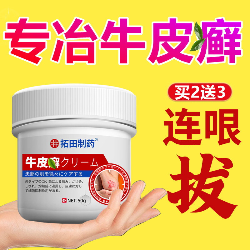 牛皮银屑病外用膏非洗发水药体藓鲜藓专用痒皮肤银屑杀菌正品