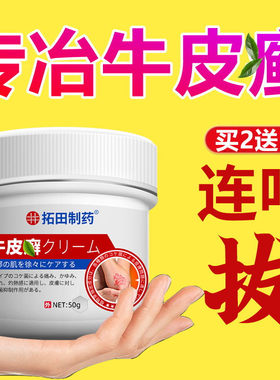 牛皮银屑病外用膏非洗发水药体藓鲜藓专用痒皮肤银屑杀菌正品