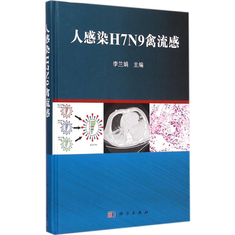 人感染79禽流感 李兰娟 主编 医学综合基础知识图书 医生医学类专业书籍 科学出版 书籍/杂志/报纸 麻醉学 原图主图