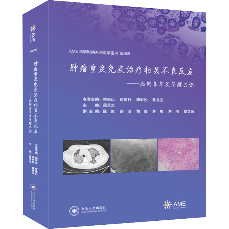 肿瘤重度免疫治疗相关不良反应——病例集萃及管理共识 周承志 编 