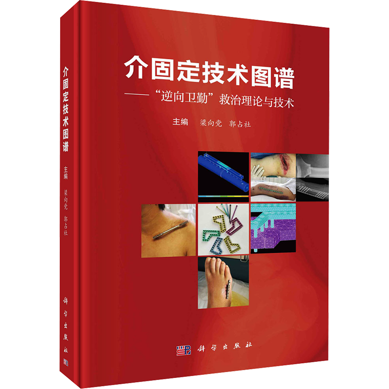 介固定技术图谱——