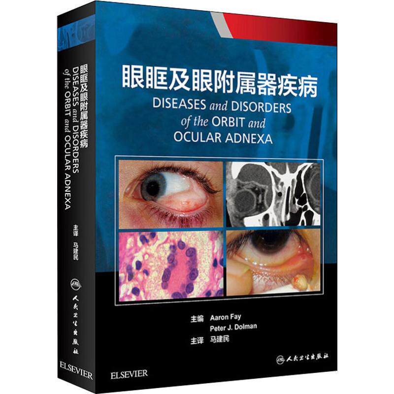 Orbital Attached disease Fay Edit Ma Jian min Basics genetics Genetic Syndrome Ophthalmology doctor study major book Eye Operation treatment diagnosis case booksin the Books/Magazine/Newspaper , Medical Health , Ophthalmology  category - from Buy2taobao.com to provide professional Taobao agent buy service