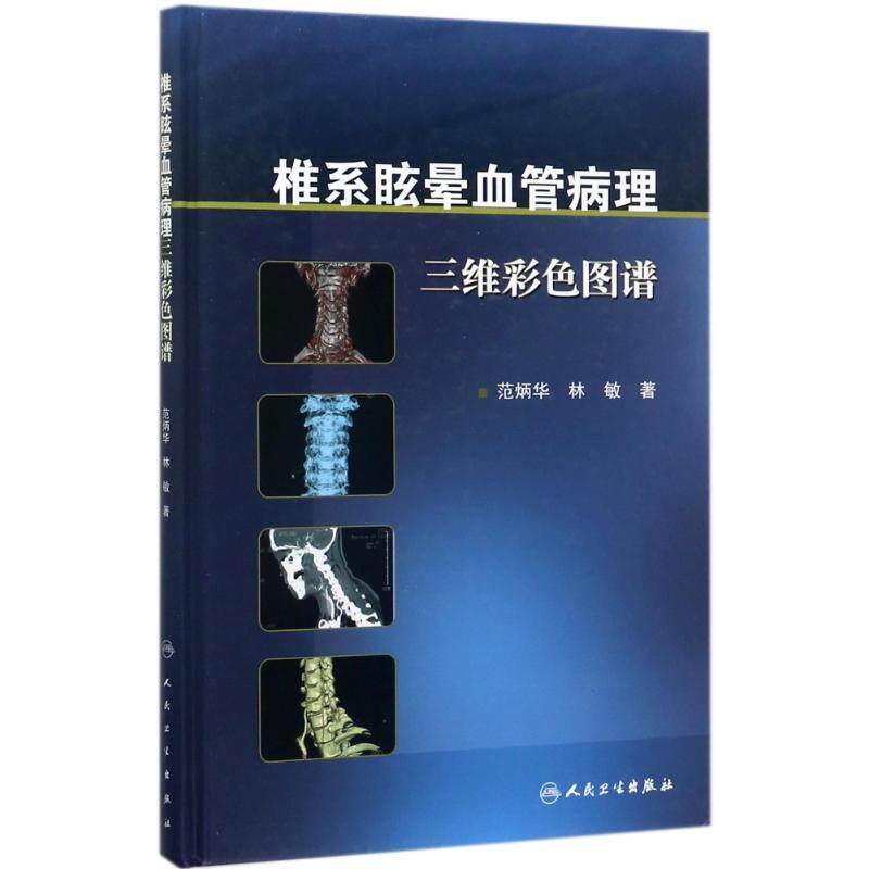 Dizziness Artery Pathology three-dimensional colour atlas Van Bing Hua,Lin Min The medicine doctor physician clinical diagnosis treatment major book Medical books the people Health Pressin the Books/Magazine/Newspaper , Medical Health , Medical Atlas  category - from Buy2taobao.com to provide professional Taobao agent buy service