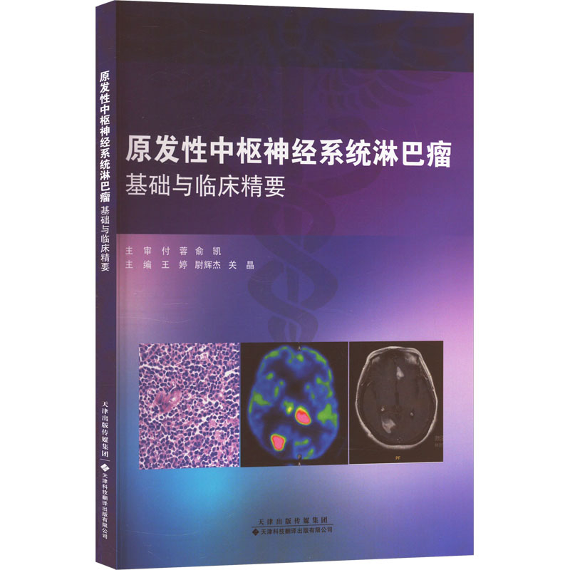 原发性中枢神经系统淋巴瘤基础与临床精要 王婷,尉辉杰,关晶 编 医学内科学医师资料专业书籍 天津科技翻译出版有限公司