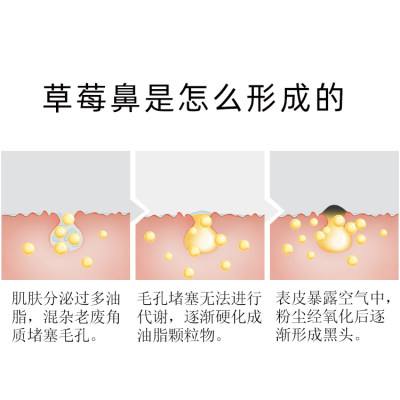 黑头导出液祛闭口粉刺水去黑头收缩毛孔美容院专用韩国小气泡院线