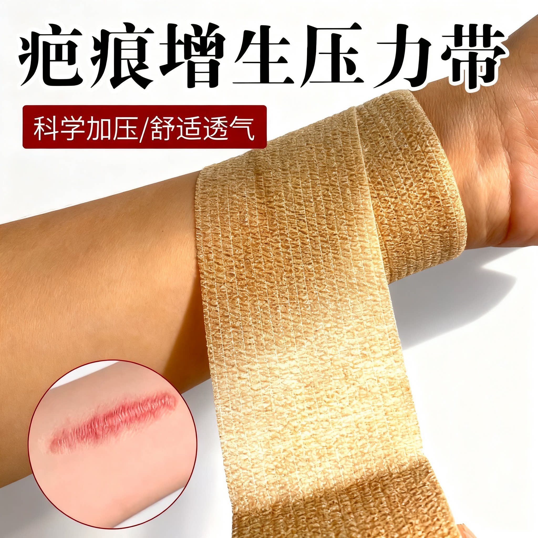 疤痕增生压力带大小腿烧