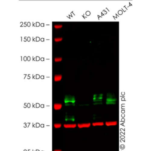 Abcam ab235578 Anti-TGF beta Receptor I 抗体10μl