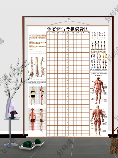 现货体态评估图瑜伽脊椎姿势系态