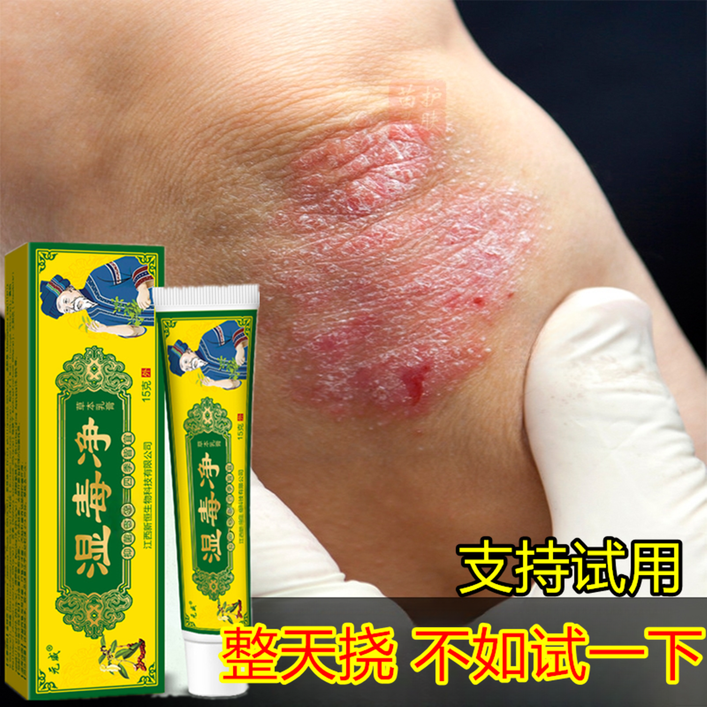 湿毒净皮肤快速止干痒膏男女大腿内侧搔痒手足头湿痒顽固藓痒乳膏