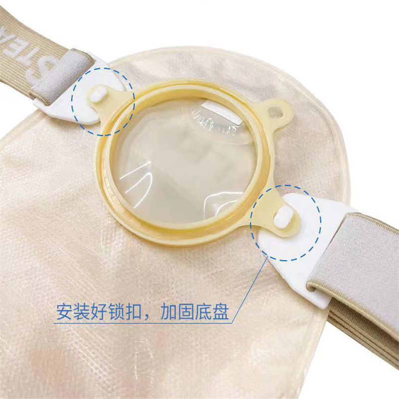 思泰利造口腰带固定器