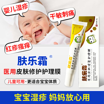 肤乐霜医用婴儿湿疹皮炎止痒膏湿疹痤疮口水疹婴儿红屁屁护臀膏
