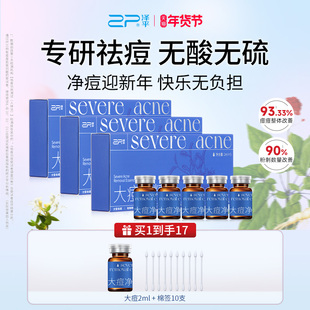 【买送正]泽平大痘净精露控油祛痘精华液改善黑头粉刺闭口青春痘