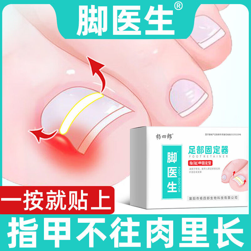 脚医生甲沟嵌甲矫正器炎正甲贴贴片脚趾指甲往肉里长专用指甲刀剪