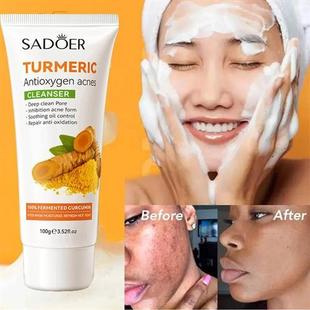 wash cleanser face spot洗面奶乳 blackhead acne gel turmeric