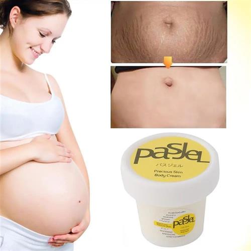 50ml Sretch Mark Repair Cream Powerful Precious Body Scar Po