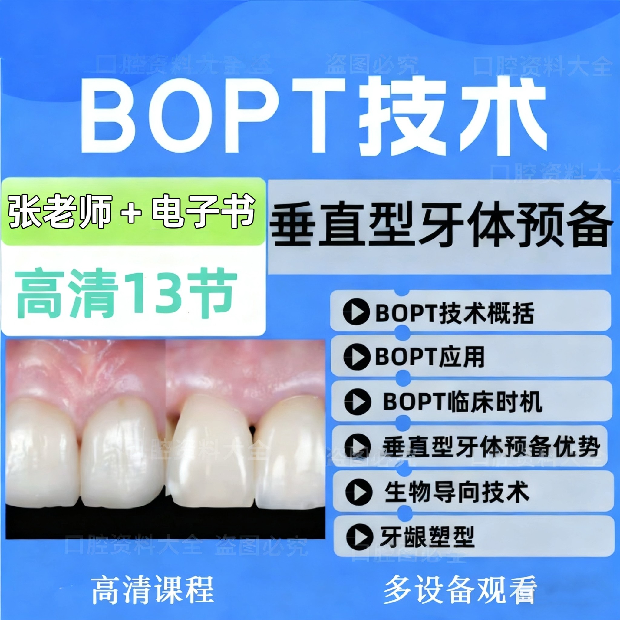 张林全冠BOPT技术与垂直型牙体预备生物导向口腔视频课程全冠预备