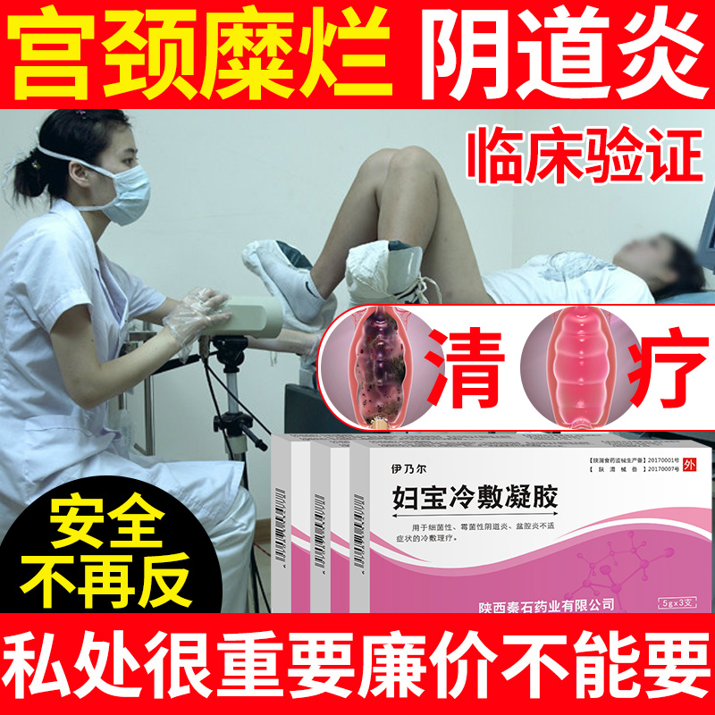 妇科凝胶冷敷宫颈烂糜用药黴菌性阴炎女性阴道白带豆腐渣私处护理