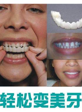 Silicone Upper  Lower False Teeth Veneers Dentures Fake