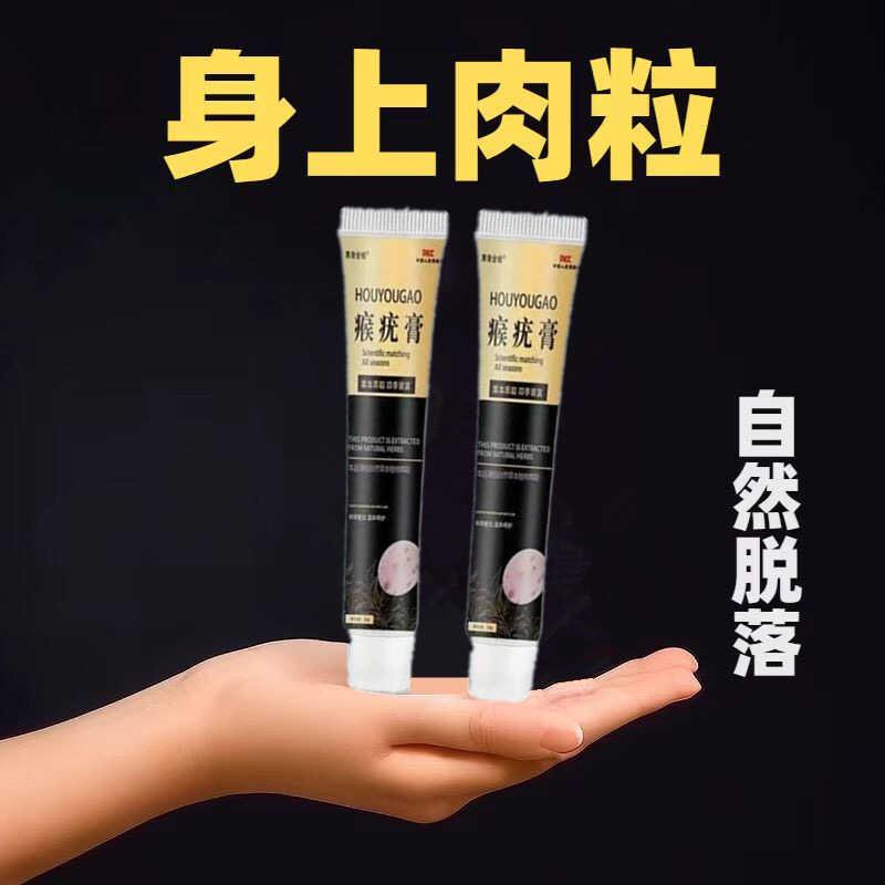 滁脖子小肉】【手全颈部脸身部脚和粒不留疤一抹灵质去膏温外用