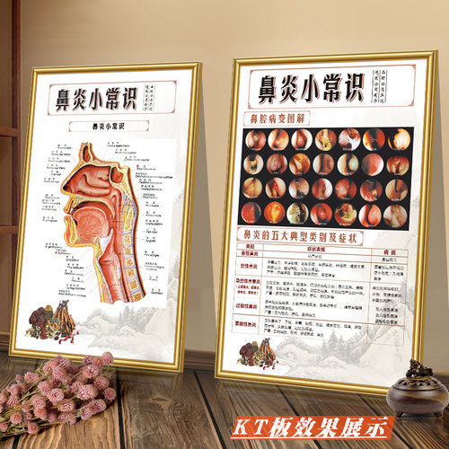 诊所宣传画结构图鼻炎科普知识