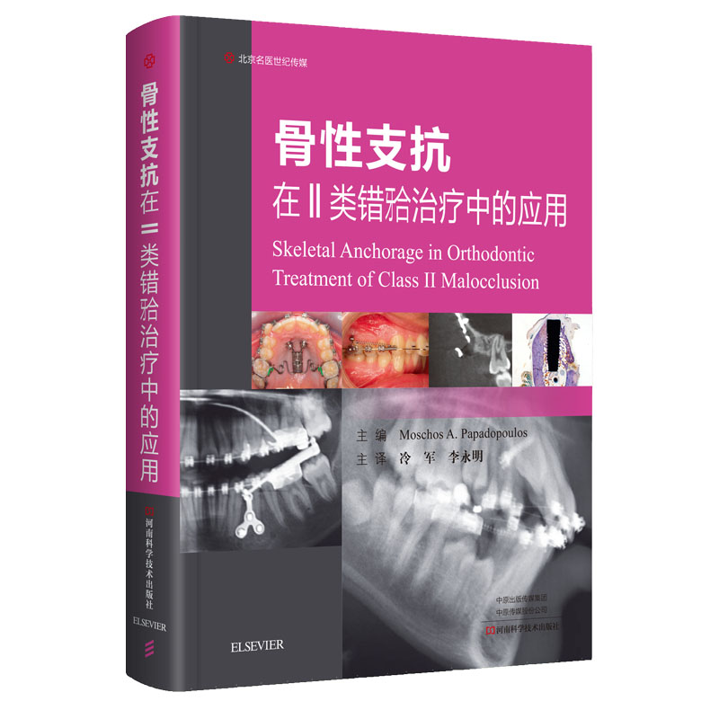 骨性支抗在II类错牙合**中的应用 口腔医学口腔正畸**教程牙齿矫正技术书籍牙科种植技术应用实例 错牙合畸形矫治河南科学技术