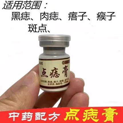 点痣膏祛斑痣无痕药水美容院专用脸部不留疤痦子取去黑痣专用神器