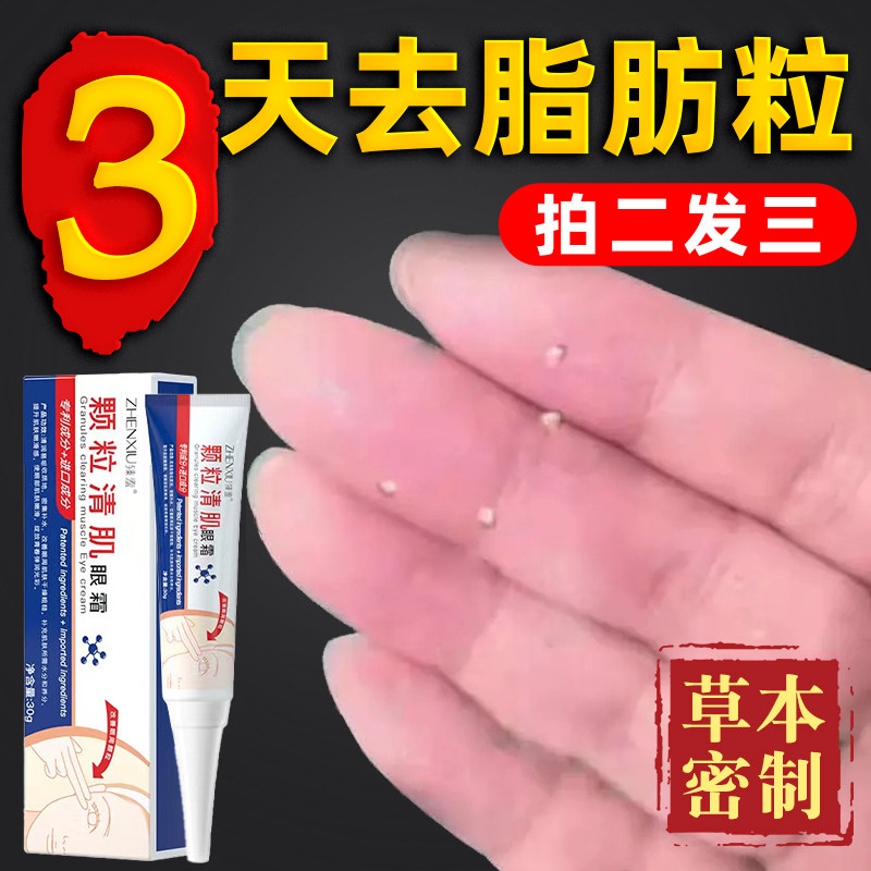 【颗粒清肌】脂肪粒去除神器汗管粒眼部油脂粒祛除牛油果眼霜