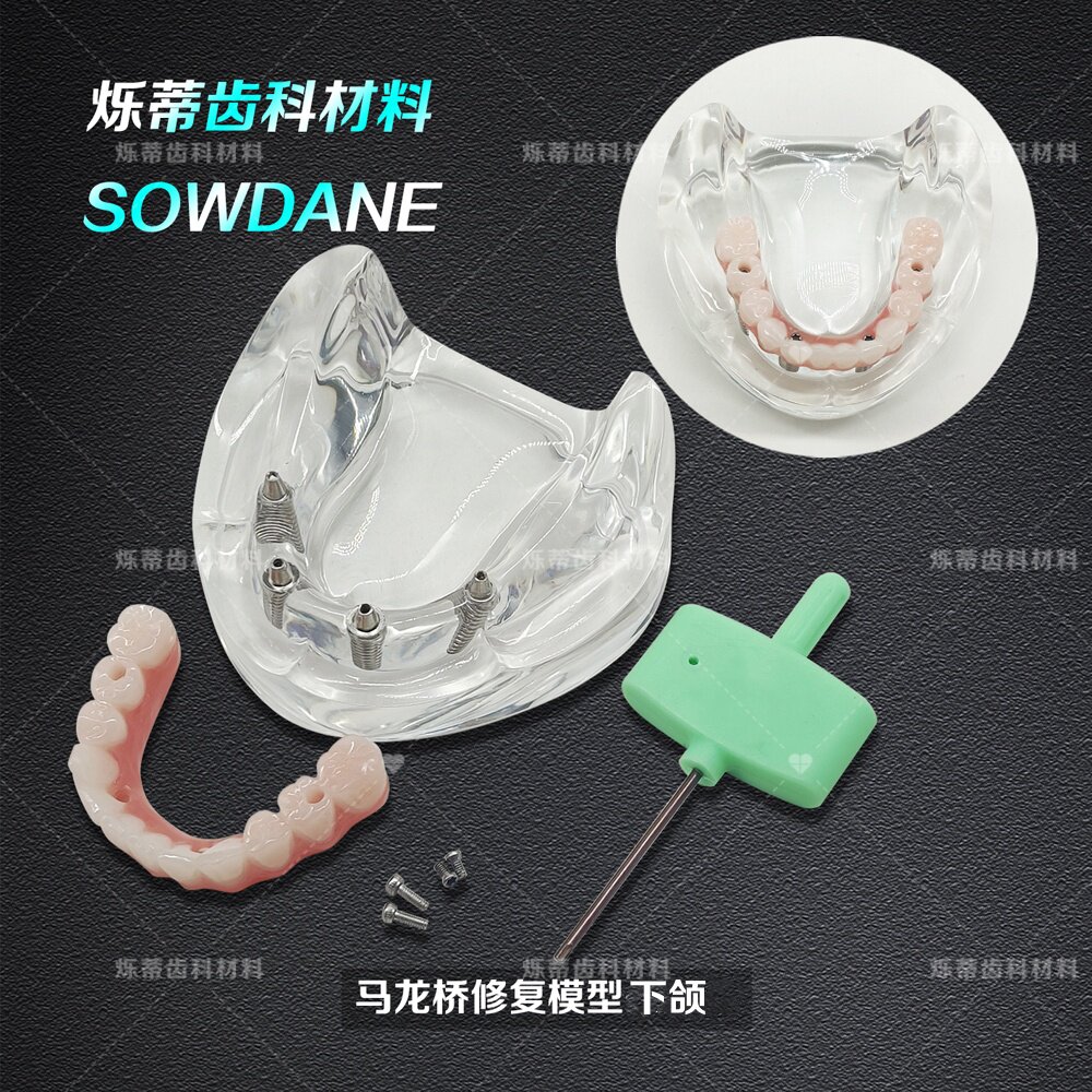 口腔模型马龙连桥义齿修复种植牙齿仿真演示模拟教学齿科医患交流