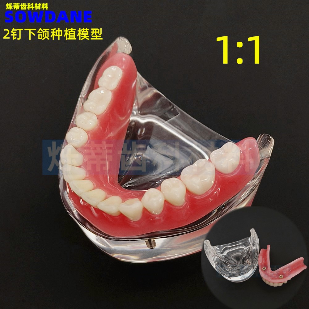 牙科上半口牙齿 牙2钉下颌医患沟通口腔微型种植钉解说展示模型