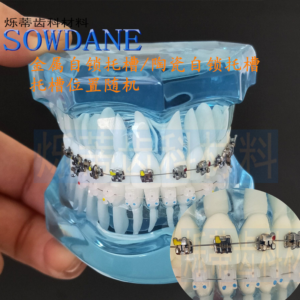 牙科牙模正畸模型对比模型透明牙模口腔教学医患沟通展示两对比