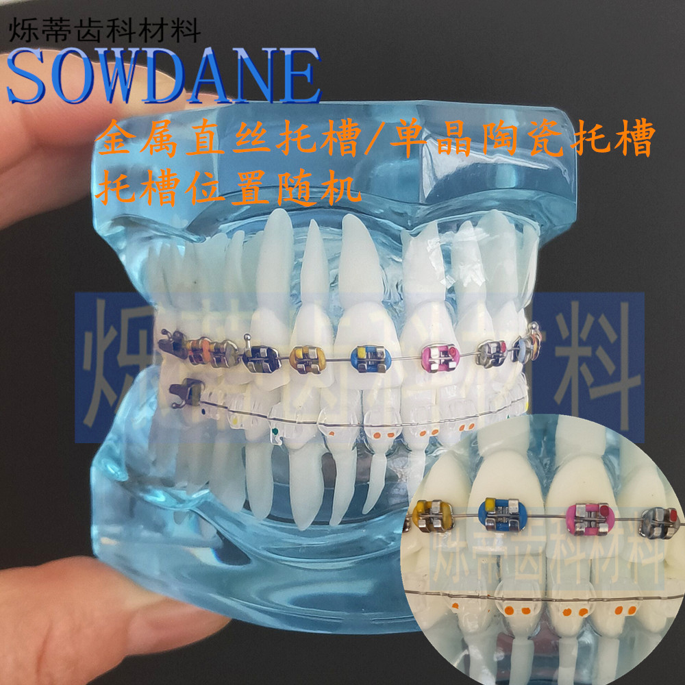 牙科牙模正畸模型对比模型透明牙模口腔教学医患沟通展示两对比