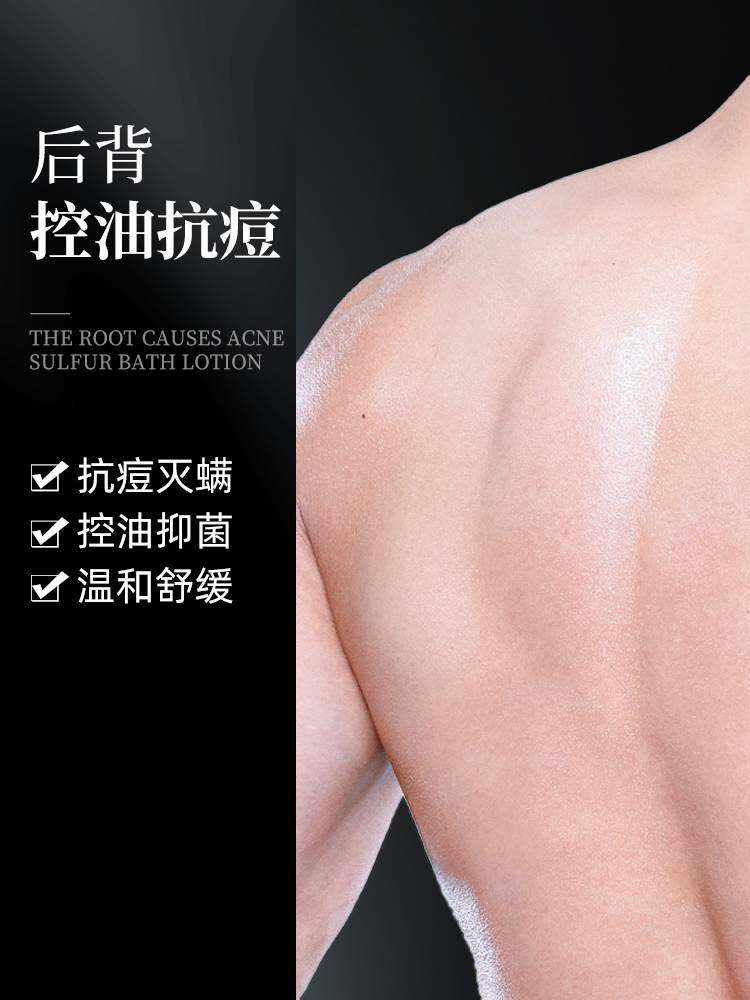 和风雨男士专用硫磺皂除螨去螨虫后背抗痘洗脸部沐浴洗澡肥皂香皂