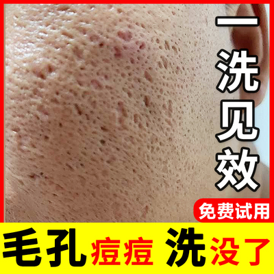 进口洁面TOPI收缩毛孔控油净痘