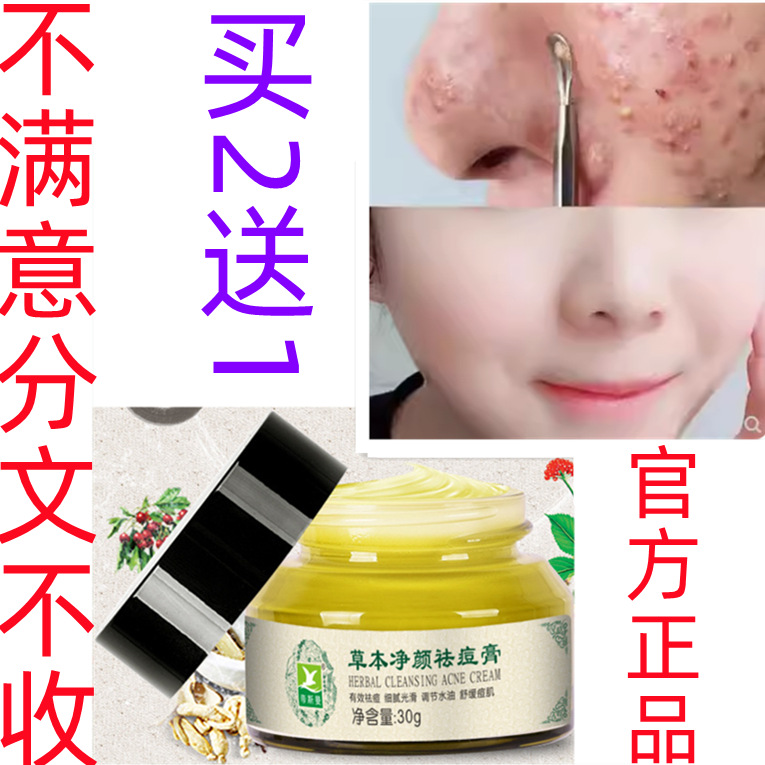 正品帝斯曼祛痘膏青春痘去粉刺女学生淡化痘印痘疤霜消印修护痘坑