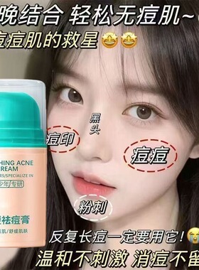 多效舒缓痘印控油保湿专研清爽