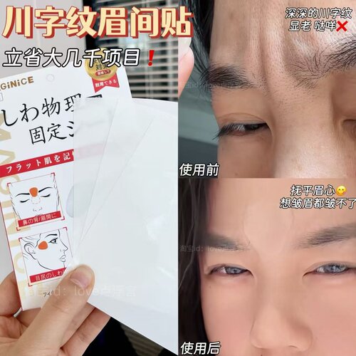 瞿颖推荐川字纹提拉紧致美容贴