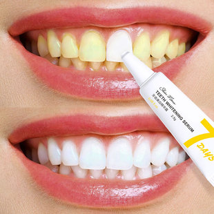 牙齿美白 速效 黄牙牙黄去黄神器焕颜精华牙渍牙垢去除器一擦即除