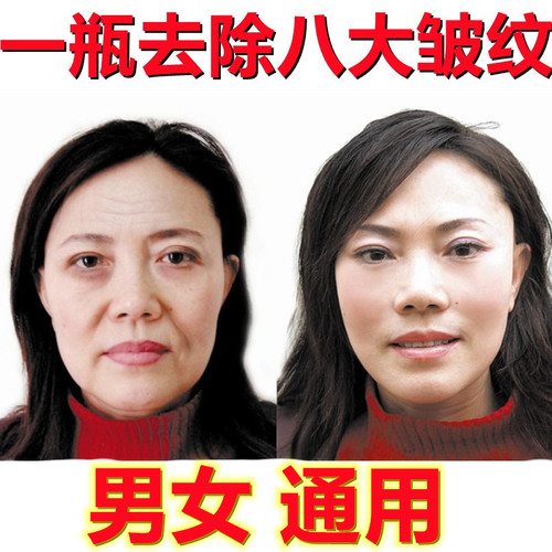六胜肽抗皱紧致淡化皱纹保湿精华液去除男女细纹面霜抗衰老护肤品