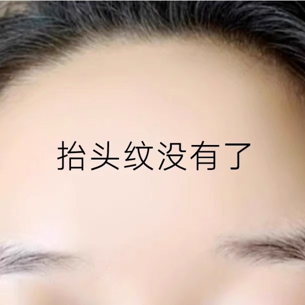 小红书推荐~抬头纹救星 川字纹额头抗皱神器 男女通用