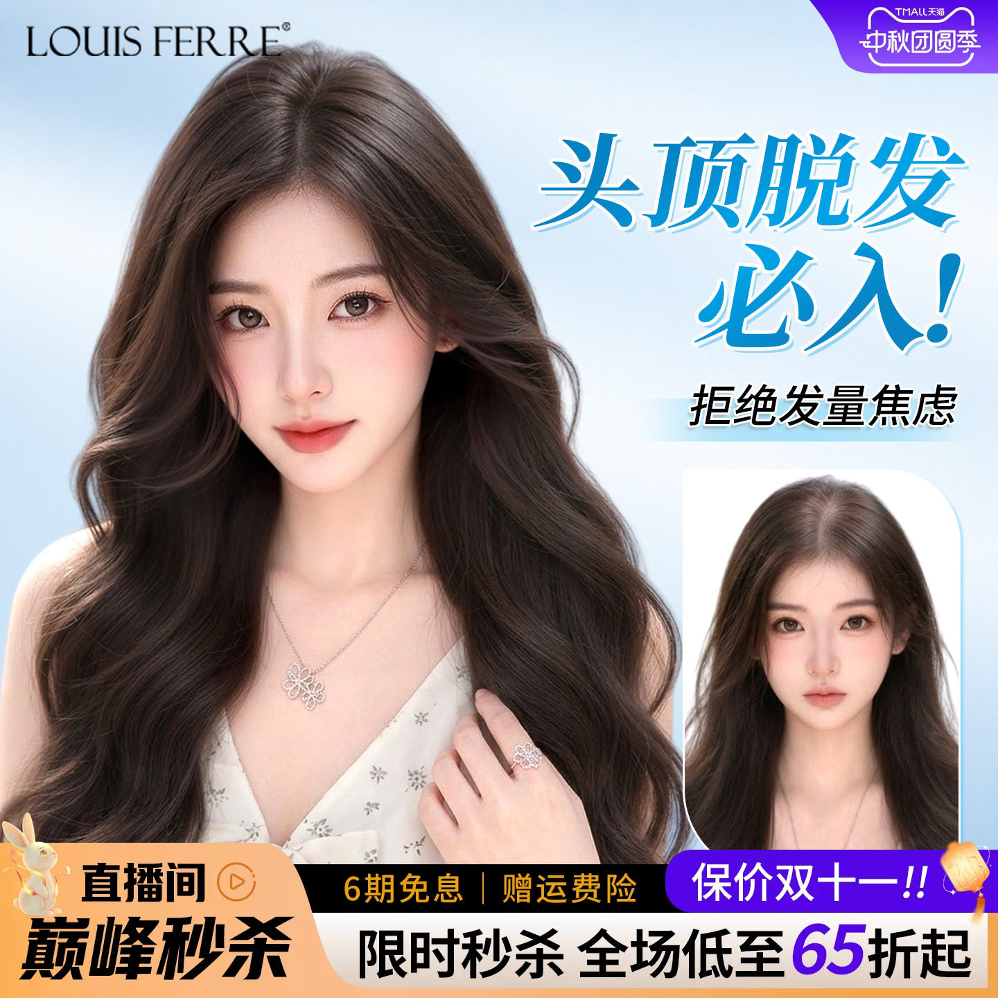 头顶脱发必入免发网假发片女全真人发遮白发长卷发补发片蓬松无痕