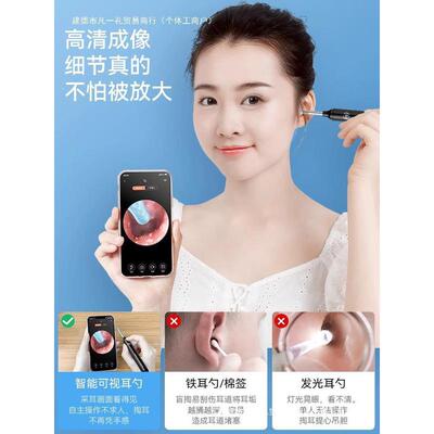 专业采耳工具掏耳朵扣耳勺发光儿童智能化可视挖耳勺掏耳高清