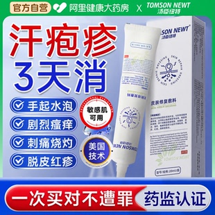 汗疱疹止痒专用根手上起小水泡汗状疱疹汉状真菌感染药房同款膏