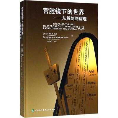 宫腔镜下的世界从解剖到病理（hysteroscopic approaches to pathologies of the genital tract)