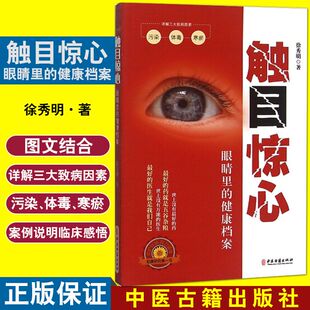 正版 触目惊心 眼睛里的健康档案 9787515207643