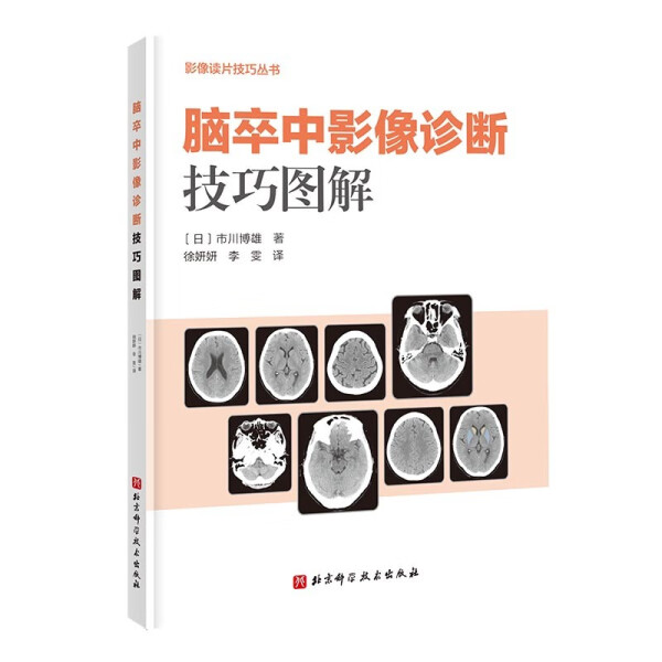 【文】脑卒中影像诊断技巧图解(日)市川博雄北京科学技术 9787571424657