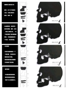 下颌运动模拟器 颞下颌关节系统演示板 牙科肌肉牙齿咬合模拟