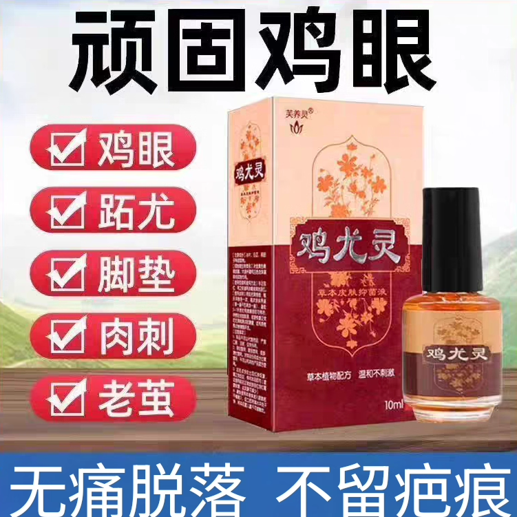 鸡尤灵皮肤抑菌液去除肉刺猴鸡眼老茧脚底足手足部关节老茧软化剂