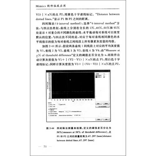 正版图书丨 Mimics软件临床应用：计算机辅助外科入门技术  苏秀云，刘蜀彬编著 9787509150139